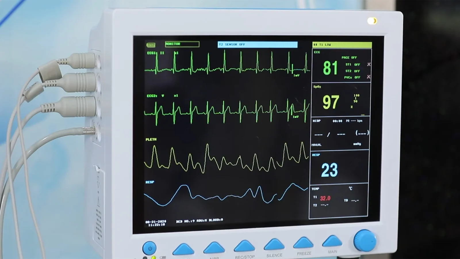 Graves vulnerabilidades en monitores de pacientes Contec CMS8000: CISA y FDA advierten sobre fallos críticos